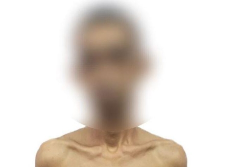 Mototaxista que estuprou adolescente fez mais duas vítimas no Amazonas 