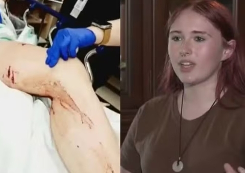 Adolescente sobrevive a ataque de jacaré durante banho de riacho