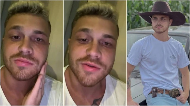 Pacientes com paralisia de Bell costumam ter rápida recuperação