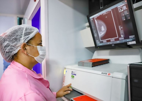 Saúde da Mulher: Confira os locais de atendimento das Unidades Móveis em Manaus