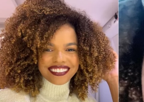 Jeniffer Nascimento fica com rosto deformado ao ter reação alérgica 