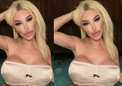 Jéssica Alves passa por novo procedimento no rosto na Turquia e choca com resultado 