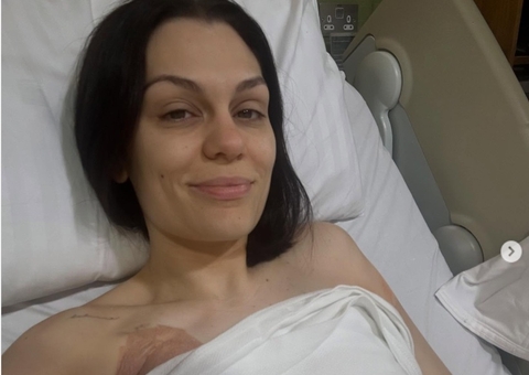 Com câncer, Jessie J passa por cirurgia 