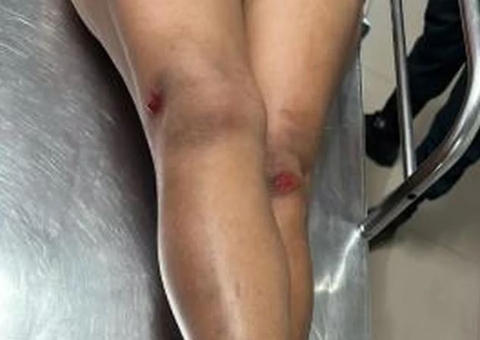 Garota de programa é agredida a tijoladas ao negar fazer programa por R$ 10