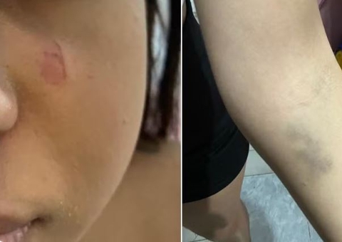 Adolescente é espancada por pedir pix de R$ 10 ao primo