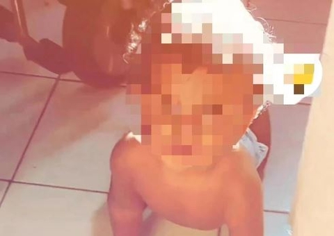 Bebê de 10 meses morre após ser atacado por cachorro durante banho