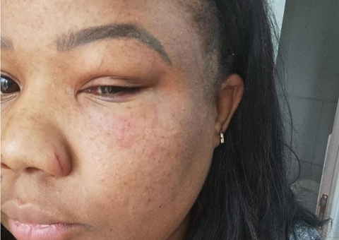 Motorista de app é espancada por passageiros após ouvir música gospel durante corrida