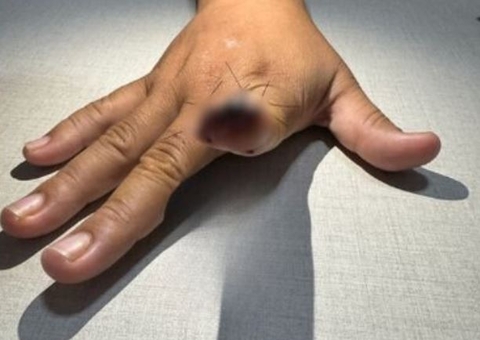 Juiz decide que prisão de homem que arrancou dedo da namorada em Manaus  