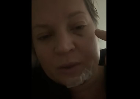 Deputada Joice Hasselmann aparece em vídeo com fraturas no rosto e dentes quebrados