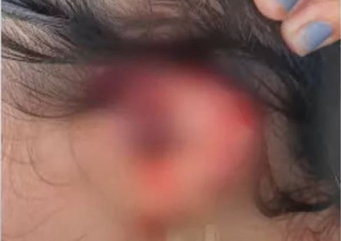 Mulher é atacada pelo marido e tem orelha cortada no Amazonas