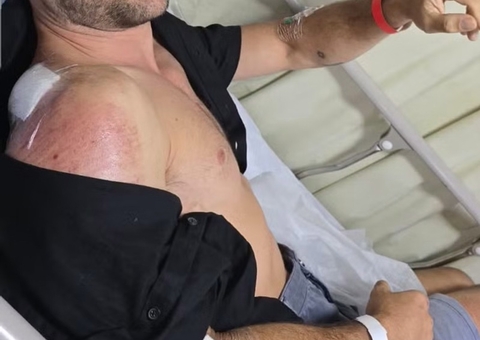 Kayky Brito sofre acidente de bicicleta dois anos após atropelamento