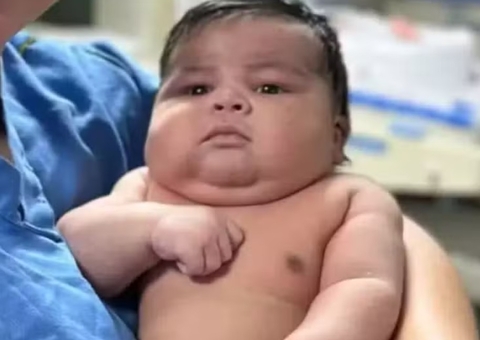 Mãe de bebê de 6,5 kg é submetida a parto normal e sofre hemorragia grave