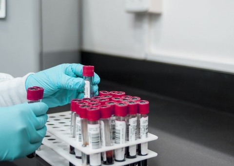 Variante delta preocupa, mas P.1. ainda predomina no Brasil, diz Fiocruz