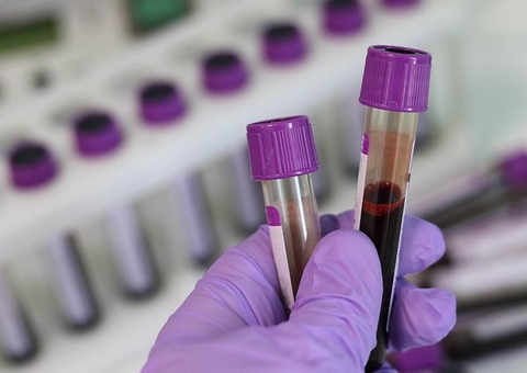 Ministério da Saúde confirma mais dois casos de varíola dos macacos