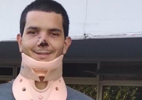 Homem relata como sobreviveu após levar tiro na cabeça