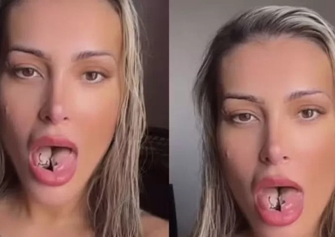 Bifurcação de língua: 15 riscos do procedimento feito por Andressa Urach
