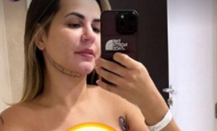 Deolane Bezerra se submete a lipoaspiração HD: ‘ficar gostosa’