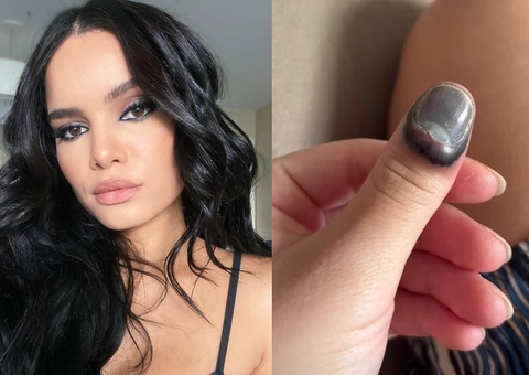 Carol Macedo passa por cirurgia após prender dedo na porta do carro 