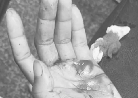 Homem é preso em hospital após esfaquear esposa em Manaus