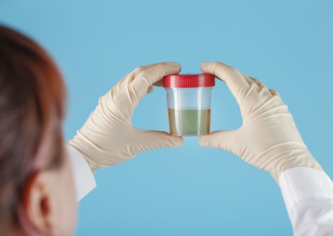 Pesquisadores brasileiros desenvolvem teste que detecta covid-19 pela urina