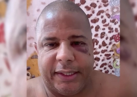 Marcelinho Carioca foi forçado a dizer que saiu com mulher casada, diz delegado