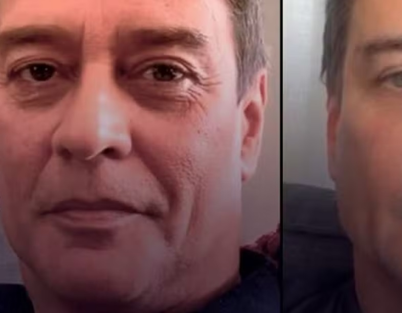 Aos 60, Marcello Antony mostra resultado de harmonização facial