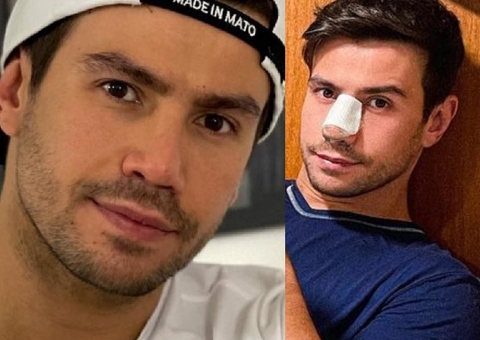 Sertanejo Mariano mostra antes e depois de 5ª cirurgia no nariz e choca fãs