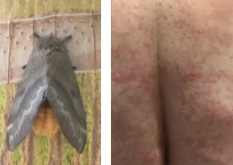 Mariposas que causaram surto no Pernambuco podem ser encontradas em todo o Brasil