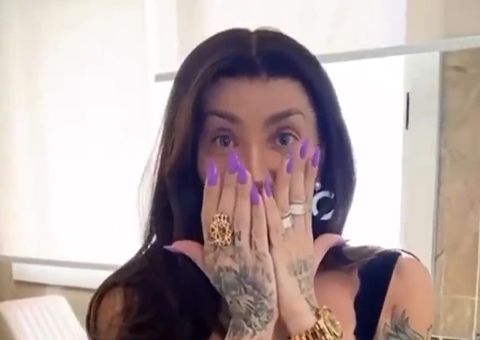 Após retirar ossos do maxilar, Maya Massafera exibe resultado: 'não se assustem'