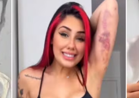 Irmã de MC Daniel, Alicia X, mostra resultado de lipoescultura 