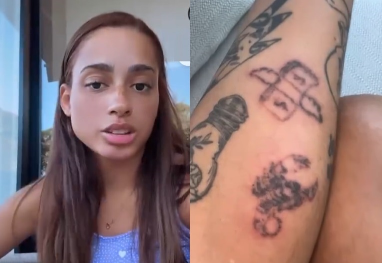 MC Loma se arrepende de tatuagens e começa processo de remoção