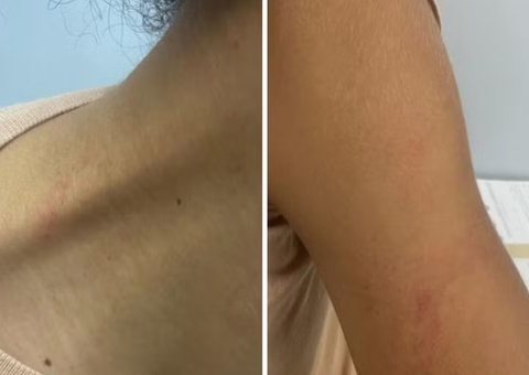 Zagueira do Manaus FC denuncia árbitro de agressão