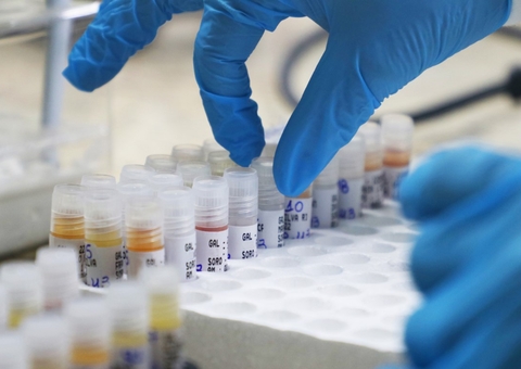 Com 715 notificações, Amazonas tem 314 casos confirmados de Mpox