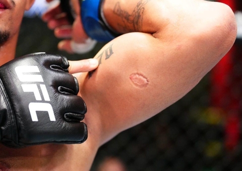 Brasileiro é demitido do UFC após morder rival durante luta; vídeo