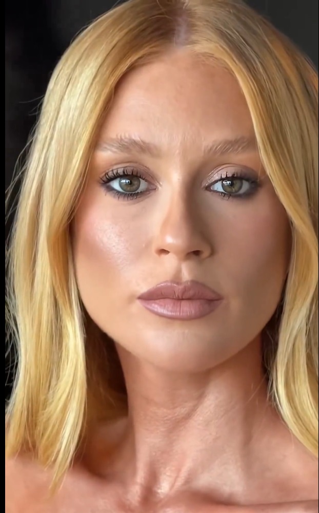 Marina Ruy Barbosa explica braço roxo durante evento em Cannes