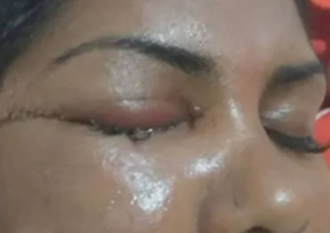 Mulher leva facada e perde visão por ouvir samba que homenageia Exu