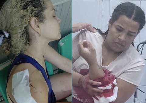 Irmãs são esfaqueadas durante briga com dona de salão em Flores; uma corre risco de perder o braço
