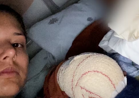 Brasileira diz que filho teve dedos decepados em escola de Portugal 'por ser imigrante e negro'