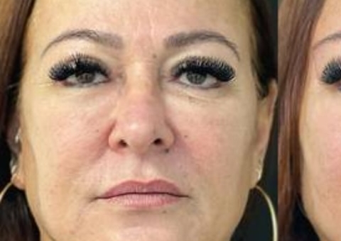 Mãe de Neymar faz recauchutagem no rosto; veja antes e depois