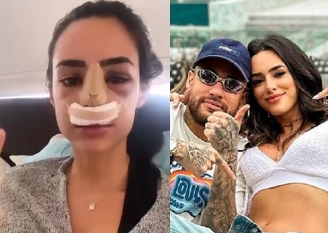 Vídeo de rinoplastia de Bruna Biancardi viraliza na internet; veja como era