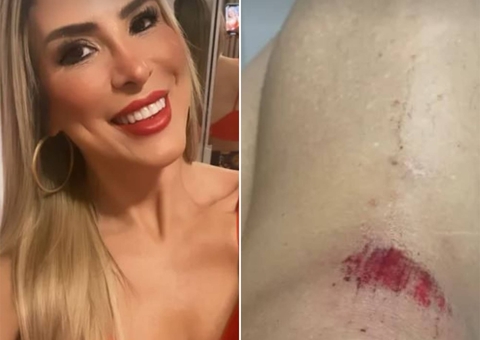 Ex-BBB é agredida por torcedores na Festa da Vitória do Boi Caprichoso em Manaus