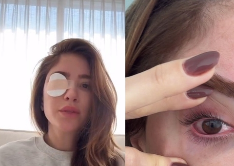 Romana Novais sofre lesão nos olhos após procedimento nos cílios: 'pior dor que já senti na vida'