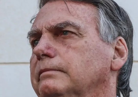 Bolsonaro alega dores de cabeça intensas devido a barulho de gerador na PF