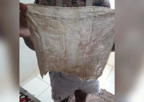 Após meses de dor, mulher descobre pano no ânus esquecido durante cesárea