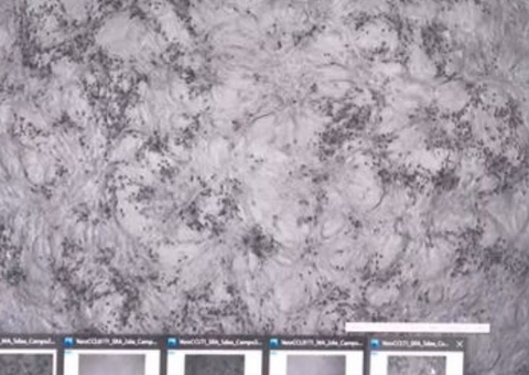 Rio de Janeiro confirma primeiro caso da variante Ômicron