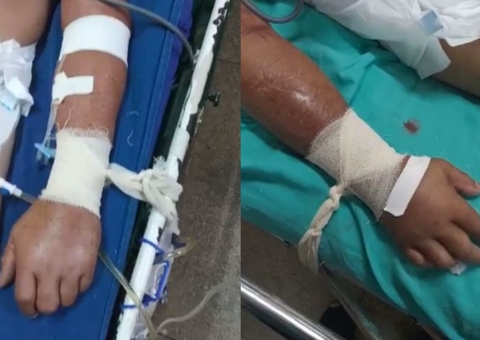 Pacientes com Covid-19 são amarrados a macas em hospital do Amazonas