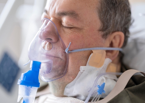 Influenza A é causa de 74% das mortes por síndrome respiratória, segundo Fiocruz