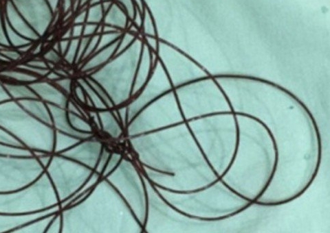 Homem vai parar no hospital após enfiar fio de nylon no pênis 