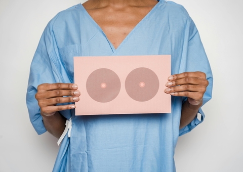 Técnica de congelamento do câncer na mama mostra 100% de eficácia em estudo brasileiro