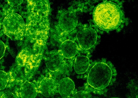 H3N2 mata quatro pessoas em Manaus e ultrapassa 1 mil casos no Amazonas